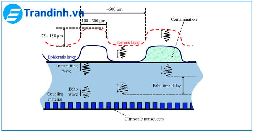 Cảm Biến Sóng Siêu Âm