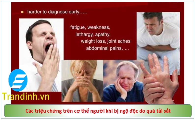 Các triệu chứng giai đoạn hậu ngộ độc sắt